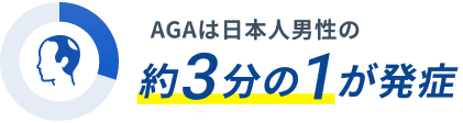 AGAは日本人男性の約3分の1が発症