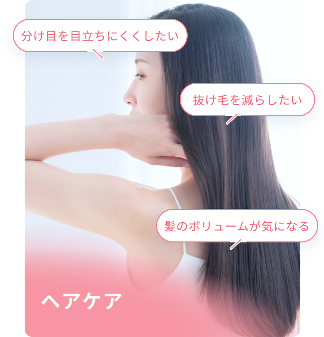 女性AGA