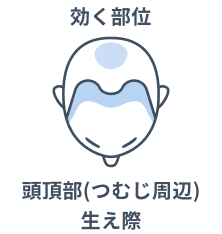効く部位 頭頂部（つむじ周辺）、生え際