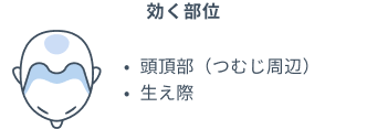 効く部位 頭頂部（つむじ周辺）、生え際