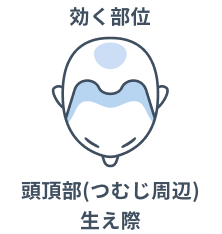 効く部位 頭頂部（つむじ周辺）、生え際