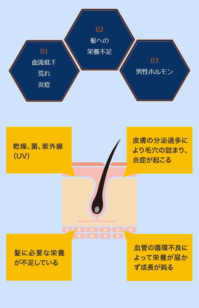 血流低下荒れ炎症 髪への栄養不足 男性ホルモン 乾燥、菌、紫外線(UV) 皮膚の分泌過多により毛穴の詰まり、炎症が起こる 髪に必要な栄養分が不足している 血管の循環不良によって栄養が届かず成長が鈍る