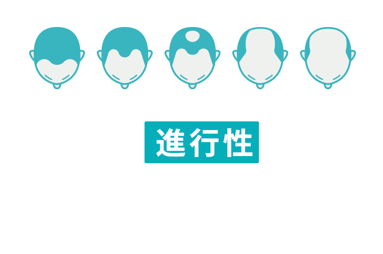 AGAは 進行性 の病気早めの治療が必要です！