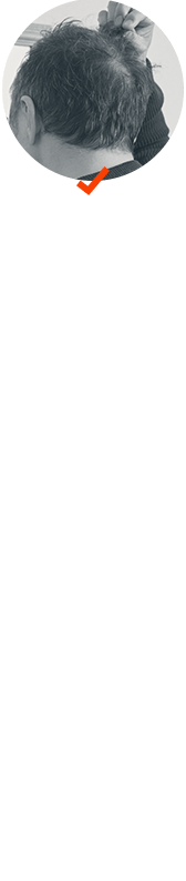 地肌が目立つ気がしてきた