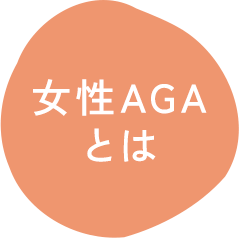 女性AGAとは
