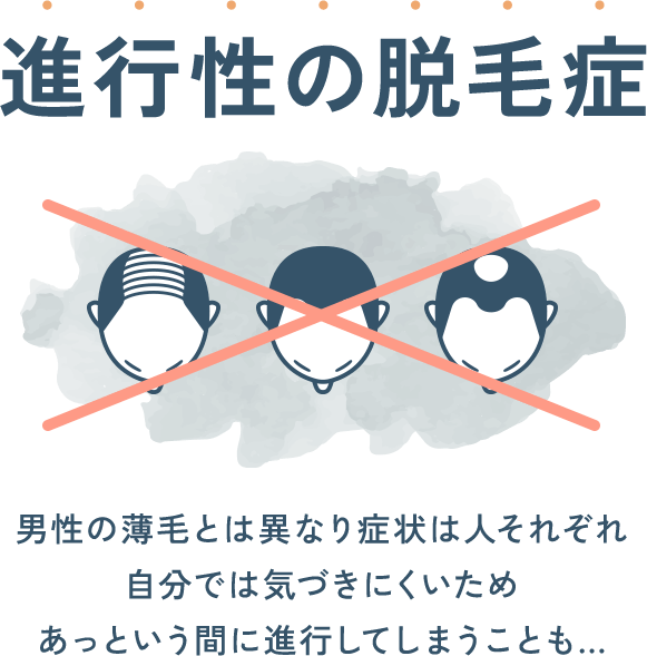 進行性の脱毛症。男性の薄毛とは異なり症状は人それぞれ自分では気づきにくいため、あっという間に進行してしまうことも...