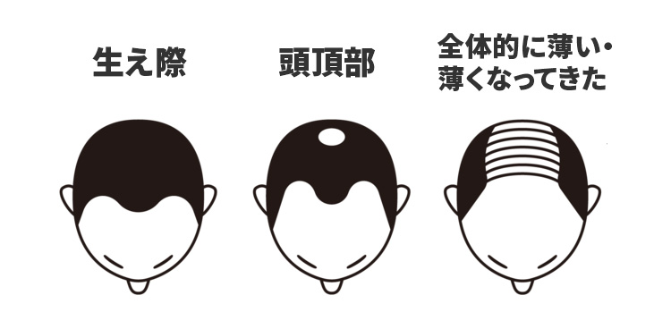 イラスト・男性頭部