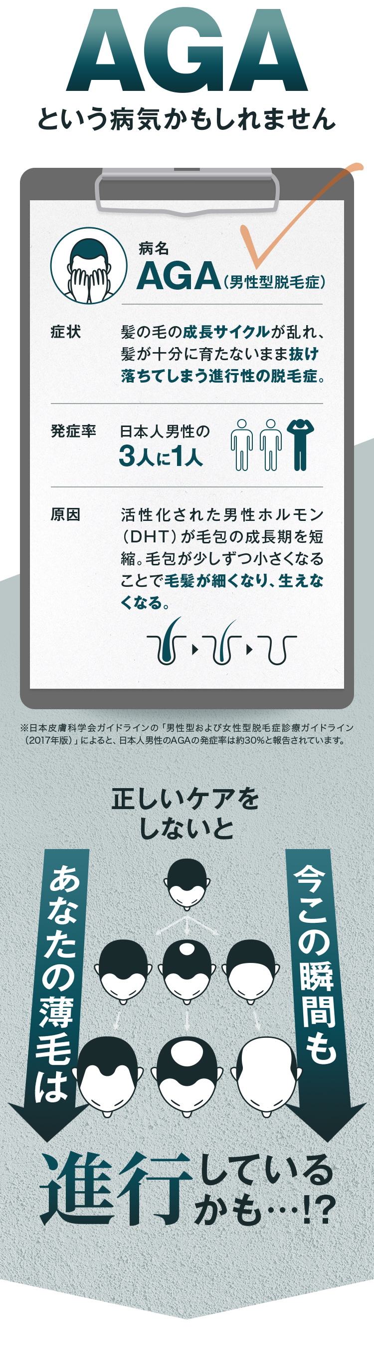 AGAという病気かもしれません
