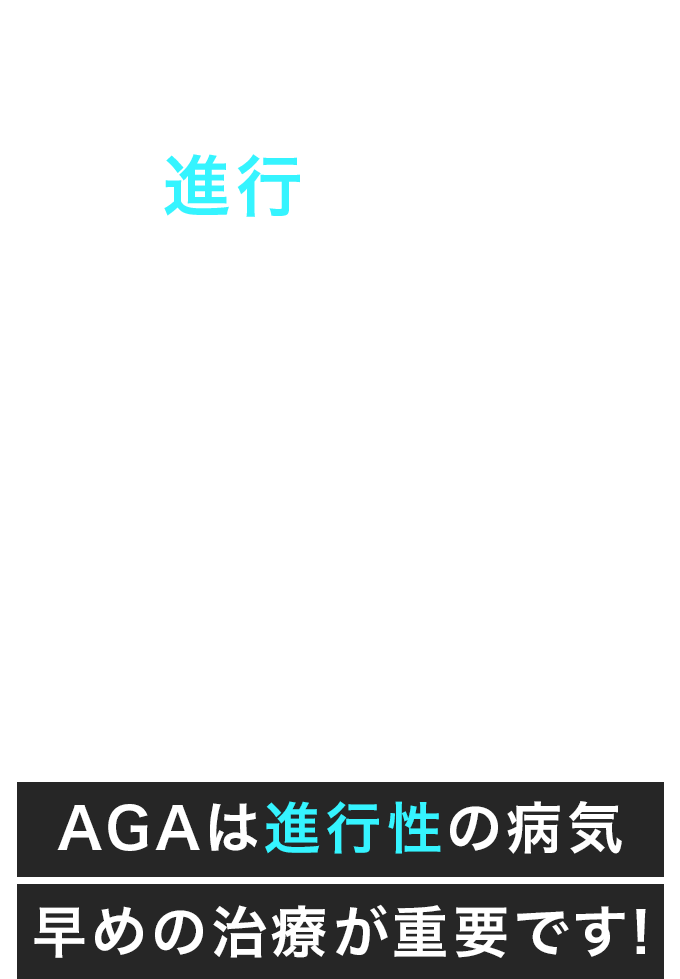 これらの原因によって薄毛や脱毛が徐々に進行してしまいます。AGAは進行性の病気、早めの治療が重要です!