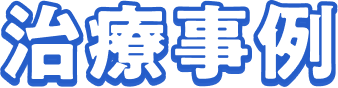 治療事例
