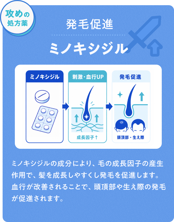攻めの処方薬 発毛促進ミノキシジル ミノキシジルの成分により、毛の成長因子の産生作用で、髪を成長しやすくし発毛を促進します。血行が改善されることで、頭頂部や生え際の発毛が促進されます。