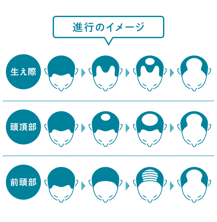 進行のイメージ